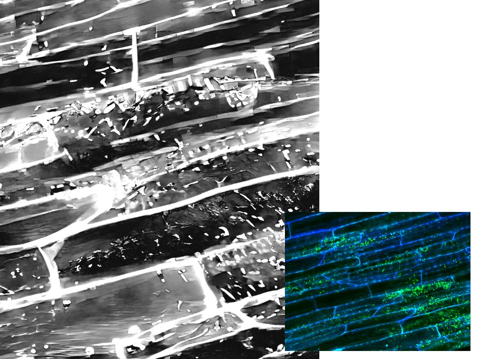 Graphic of soil bacteria, one larger photo in black and white and the same photo smaller but in color