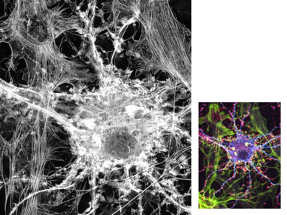 Graphic of nerve cells, one larger photo in color and the same photo smaller and in black and white