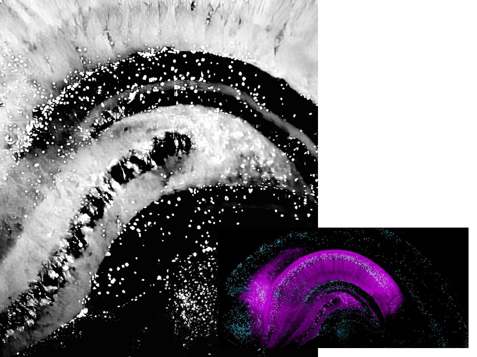 Graphic of the hippocampus, one larger photo in color and one smaller one in black and white