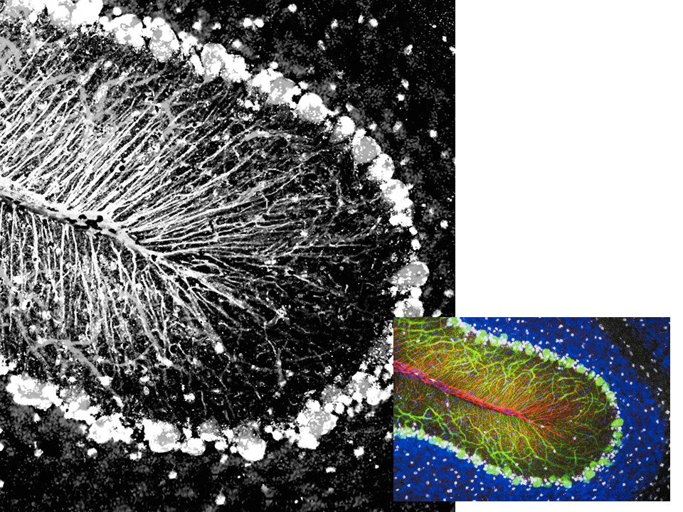 Graphic of cerebellum, one larger photo in black and white and one smaller photo in color