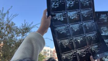 Hands holding up an x-ray photo