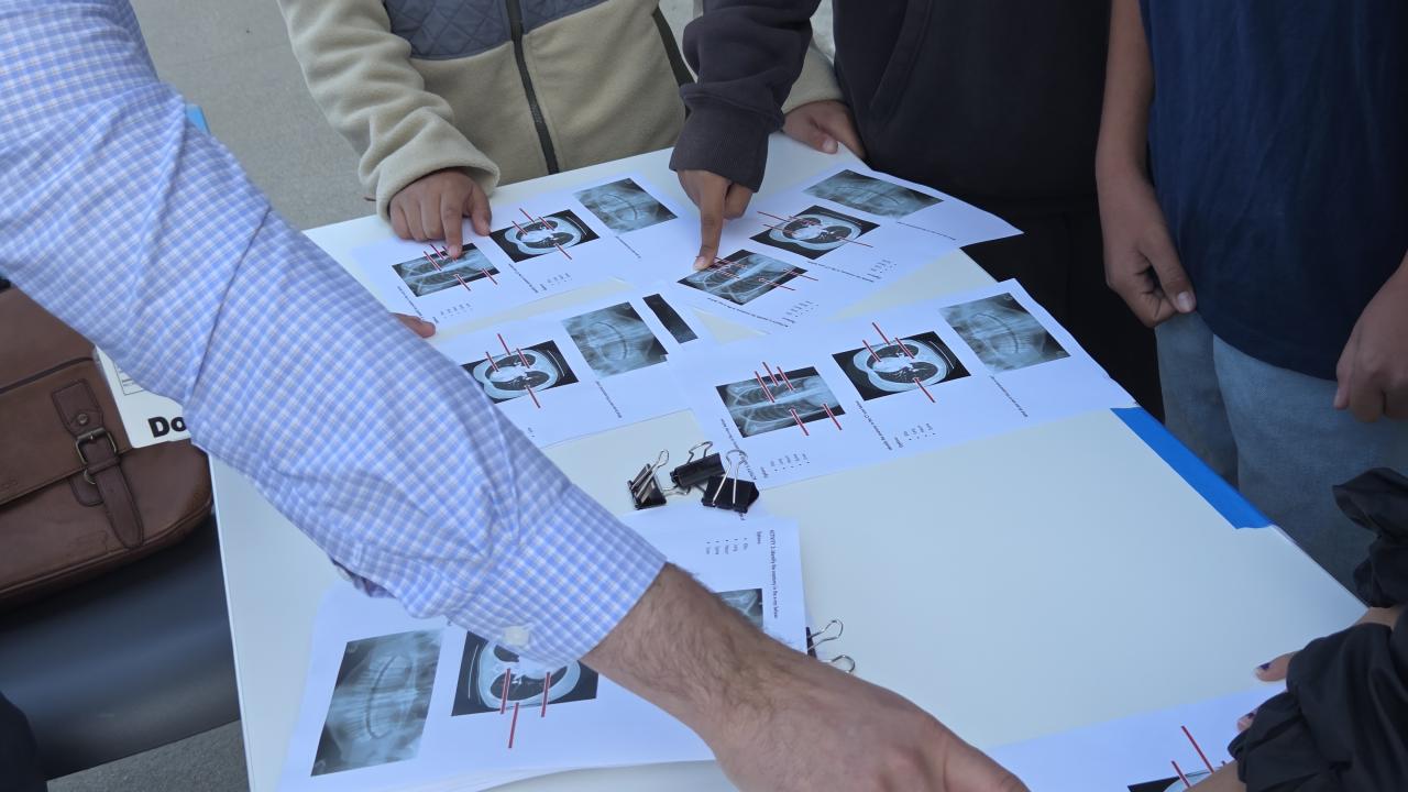 A table with x-ray photos