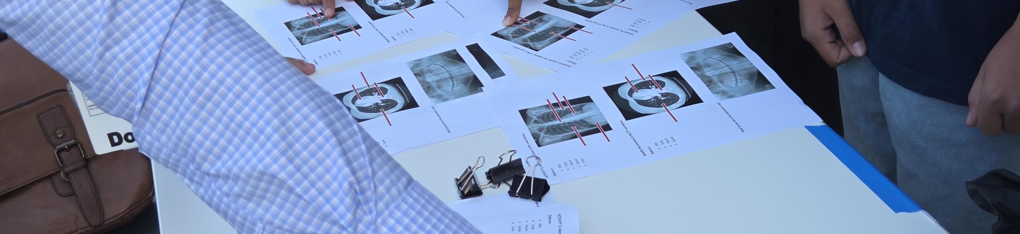 A table with x-ray photos